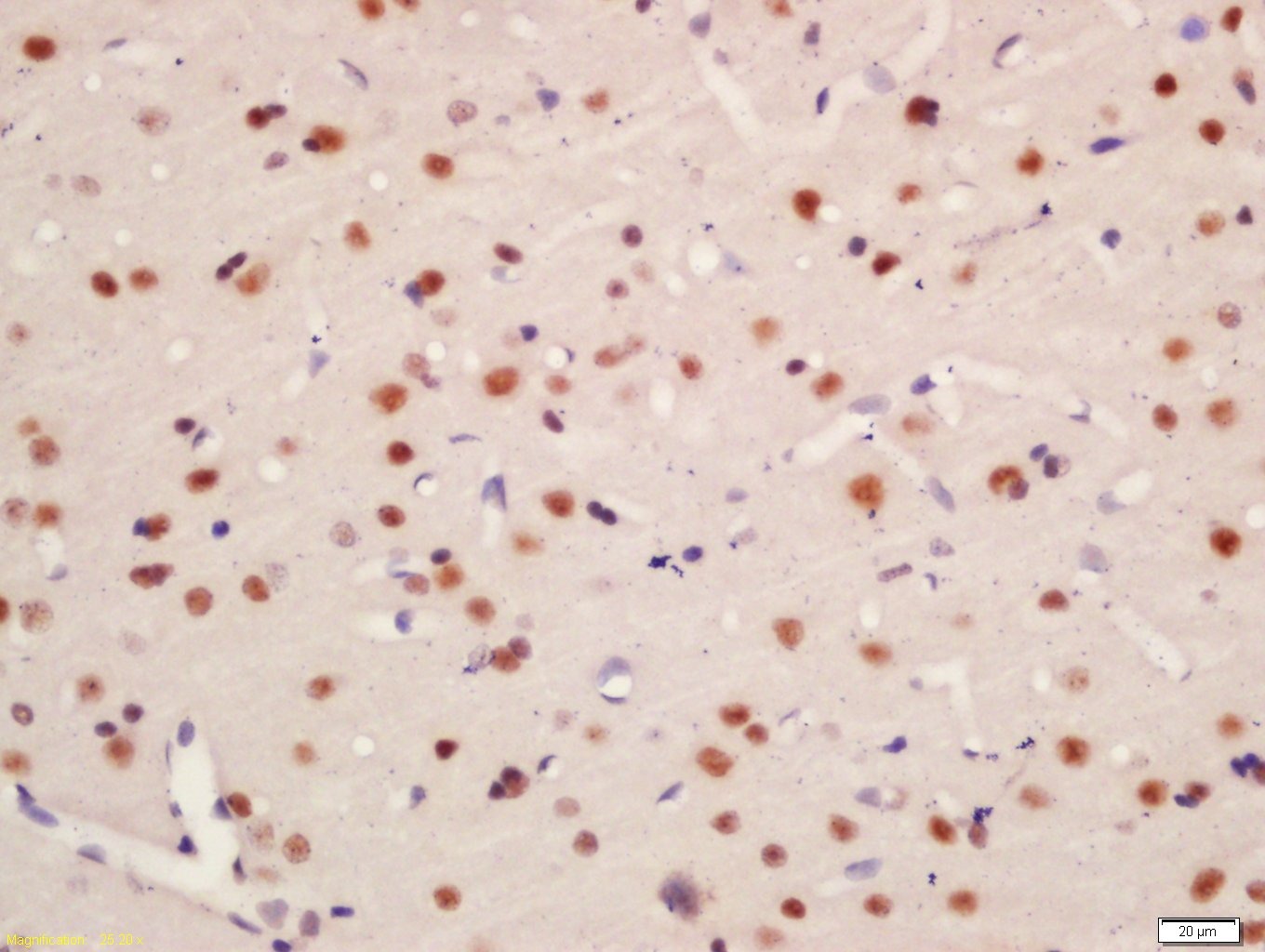 Anti-Phospho-TNIK (Ser764) Polyclonal Antibody