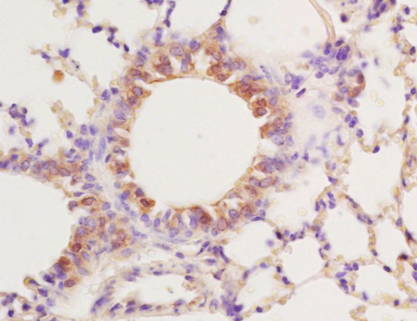 Anti-PPAR gamma/PPARG Polyclonal Antibody