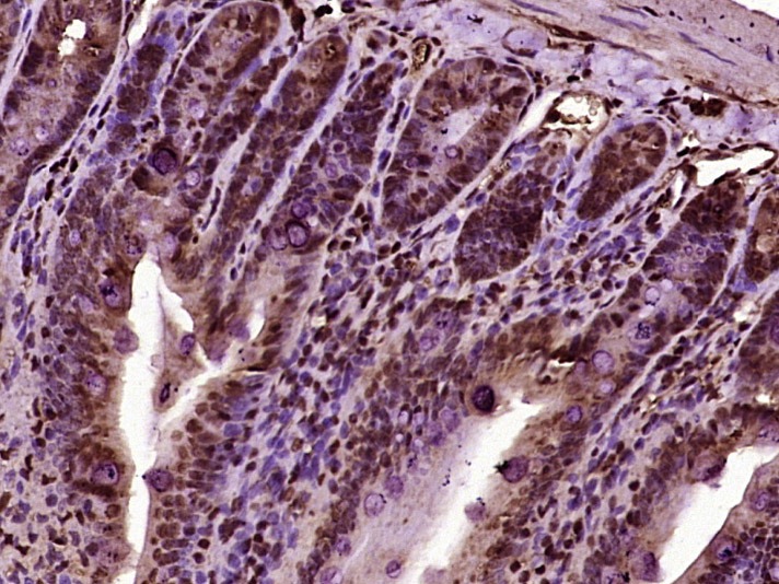 Anti-RAD51 Polyclonal Antibody