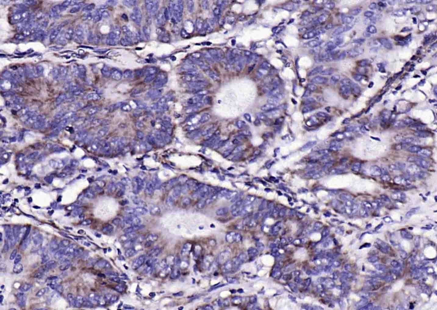 Anti-S100A10 Polyclonal Antibody