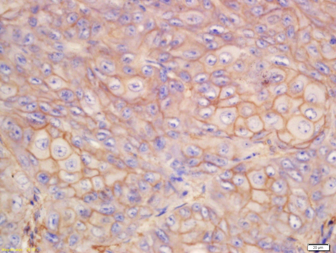 Anti-S100A10 Polyclonal Antibody