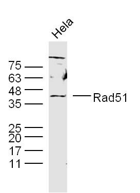 Anti-RAD51 Polyclonal Antibody