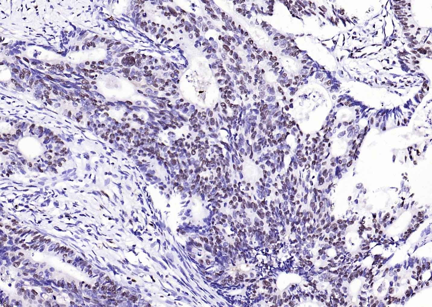 Anti-S100A8/9 Antibody (4J730)