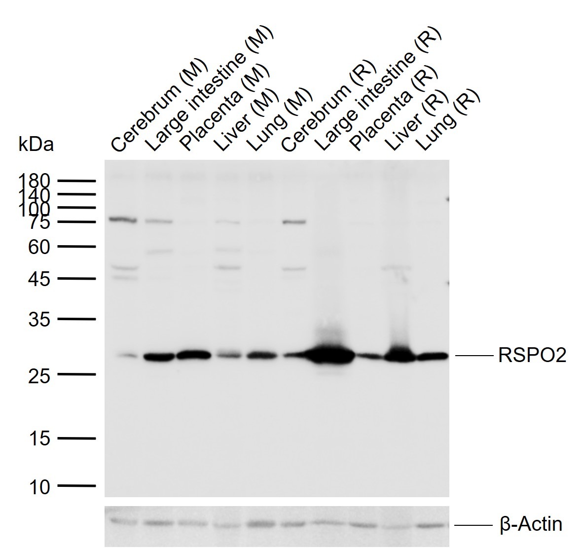 Anti-R-Spondin 2/RSPO2 Polyclonal Antibody