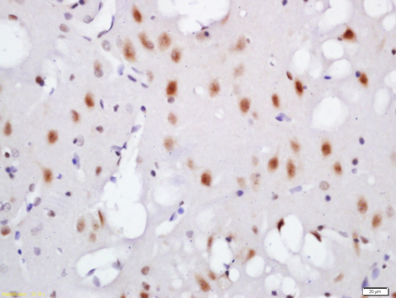 Anti-Phospho-TNIK (Ser764) Polyclonal Antibody
