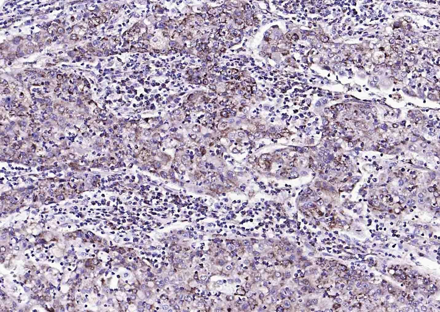 Anti-S100A10 Polyclonal Antibody