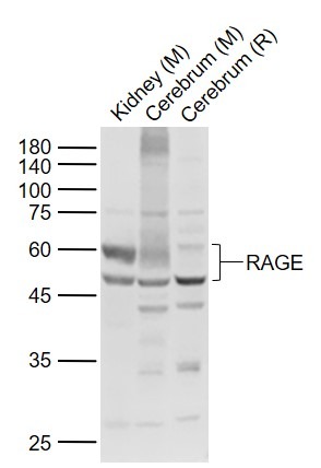 Anti-RAGE Polyclonal Antibody 2