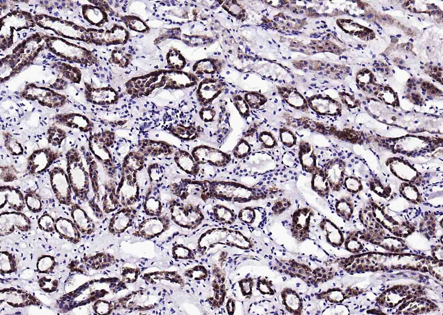 Anti-S100A10 Polyclonal Antibody