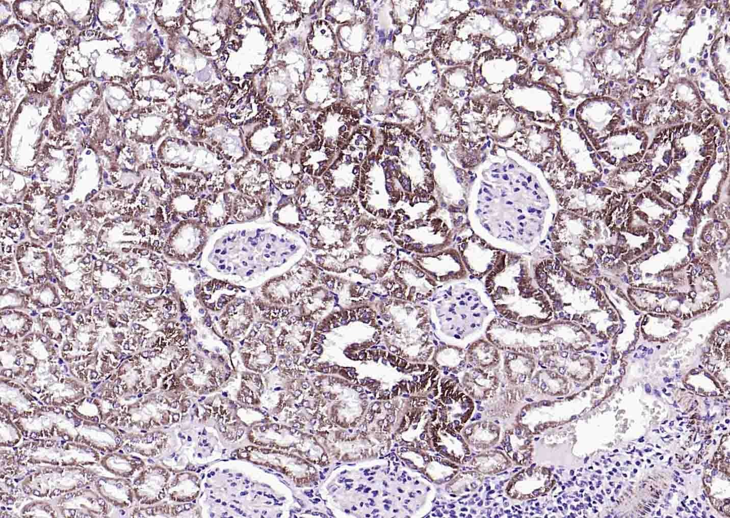 Anti-S100A10 Polyclonal Antibody