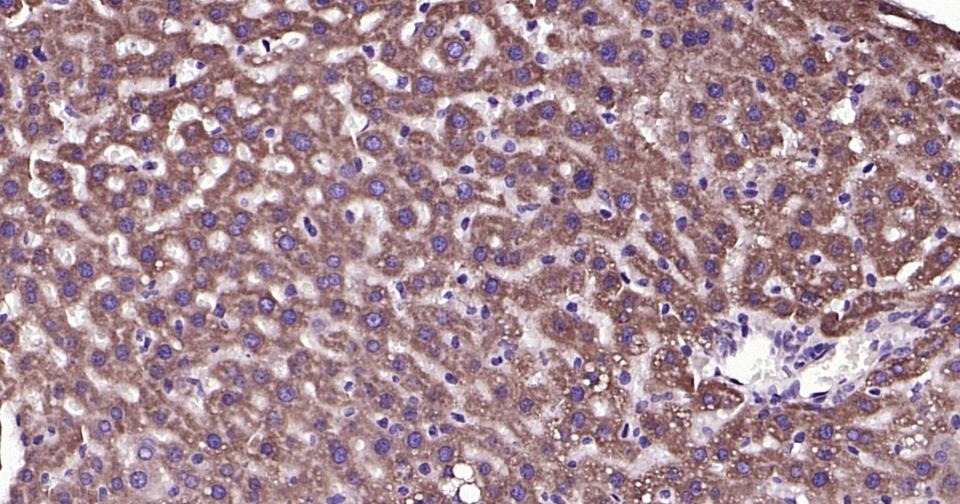Anti-Phospho-TBK1 (Ser172) Polyclonal Antibody