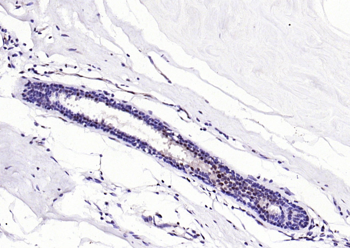 Anti-S100A8/9 Antibody (4J730)