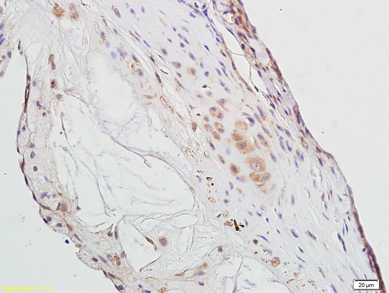 Anti-PPAR gamma/PPARG Polyclonal Antibody 2