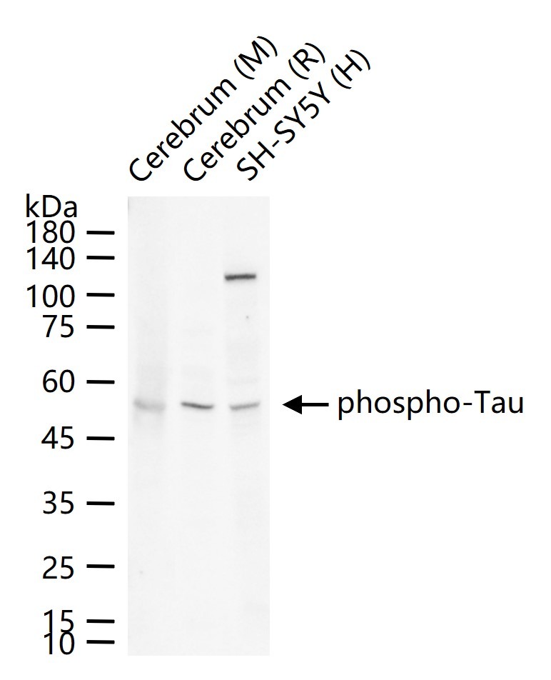 Anti-Phospho-Tau (Thr181) Polyclonal Antibody 2