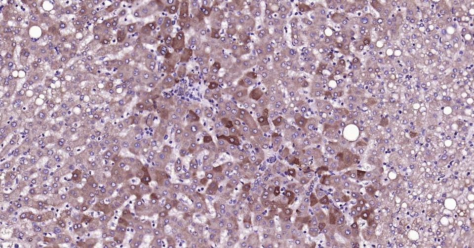 Anti-Phospho-TBK1 (Ser172) Polyclonal Antibody