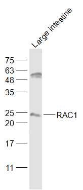 Anti-RAC1 Polyclonal Antibody
