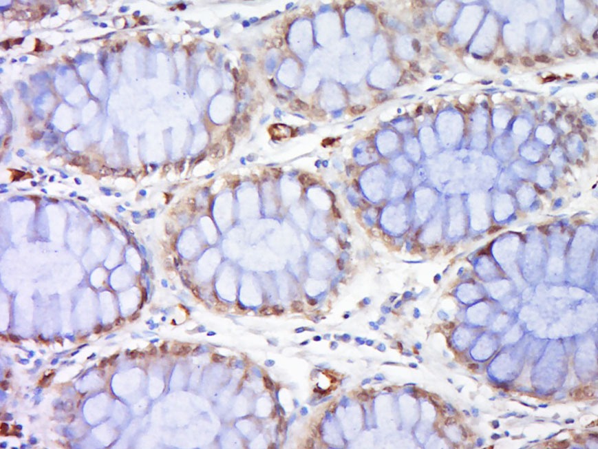 Anti-RAD51 Polyclonal Antibody