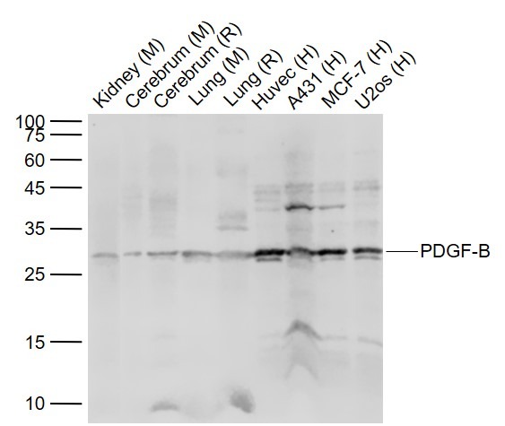 Anti-PDGF-BB Polyclonal Antibody