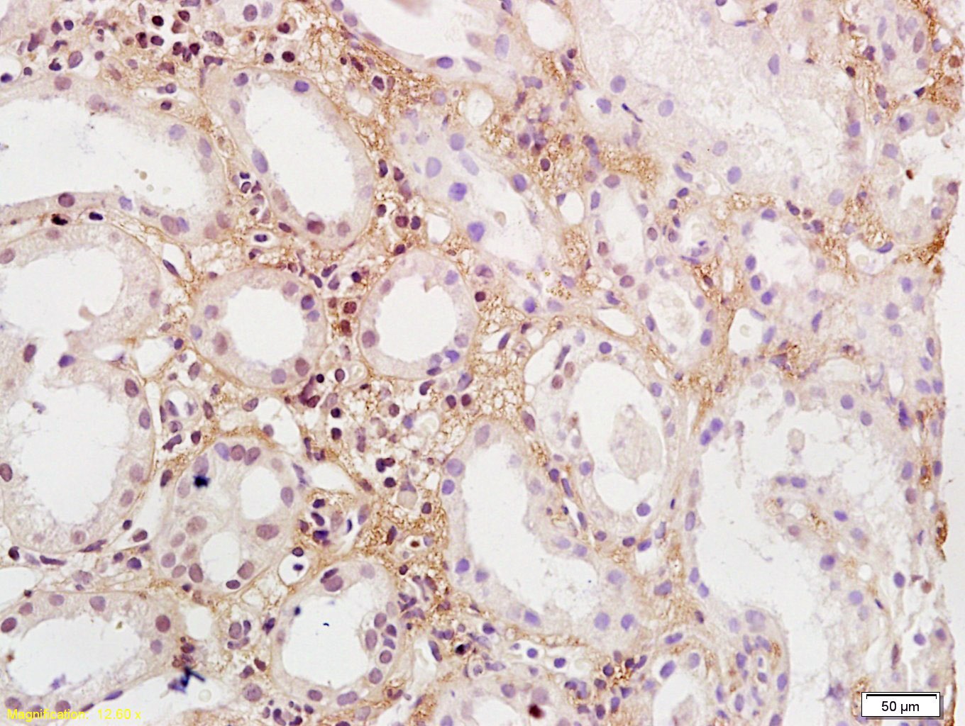 Anti-PDGF-BB Polyclonal Antibody 2