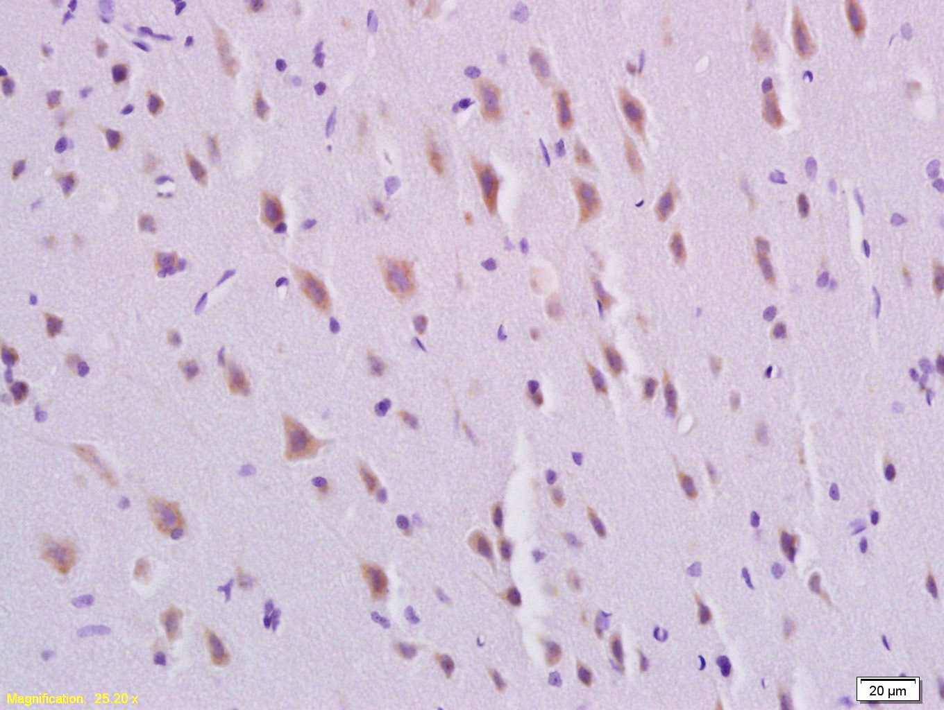 Anti-PDGF-BB Polyclonal Antibody 2