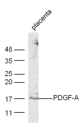 Anti-PDGF-AA Polyclonal Antibody