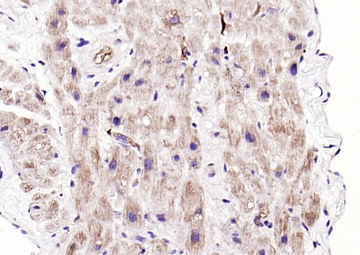 Anti-PDK4 Polyclonal Antibody