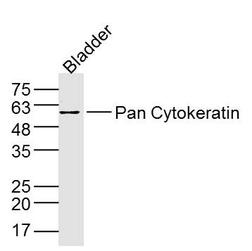 Anti-Pan Cytokeratin Polyclonal Antibody 2