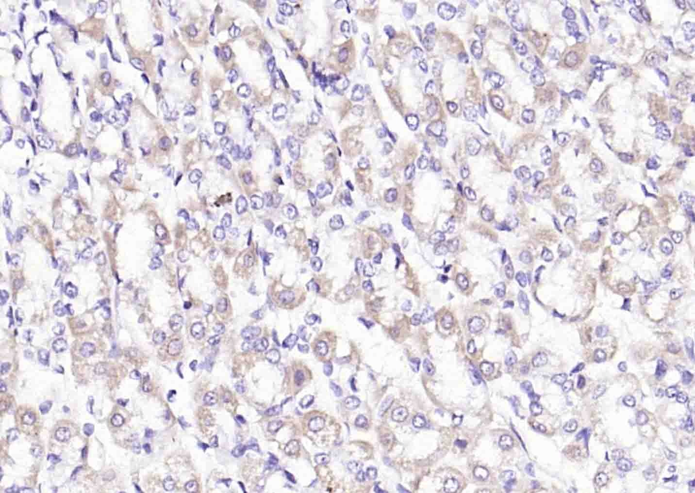 Anti-PDHA1 Polyclonal Antibody