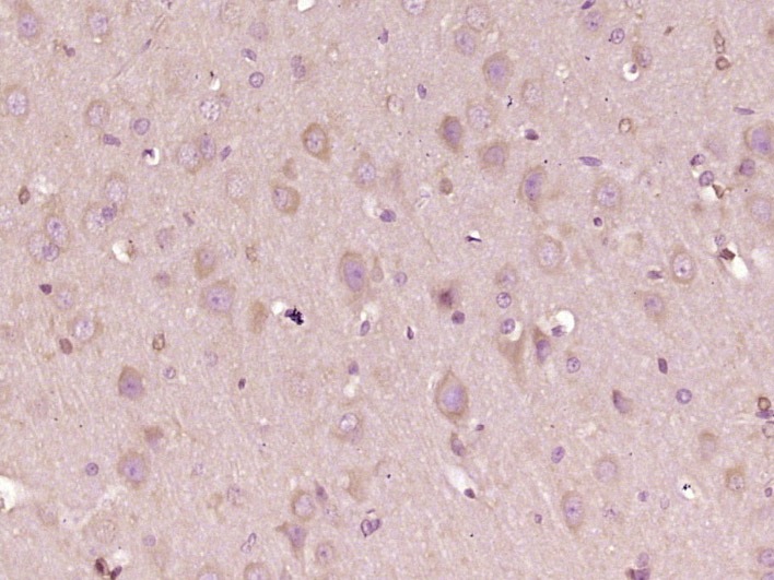 Anti-PDZD8 Polyclonal Antibody