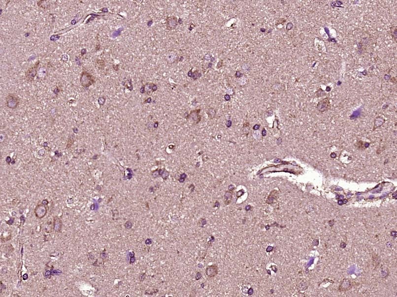 Anti-PEDF Polyclonal Antibody