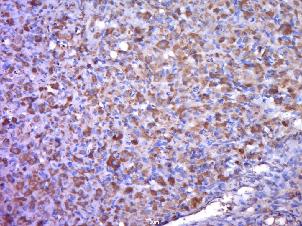 Anti-Perilipin A Polyclonal Antibody