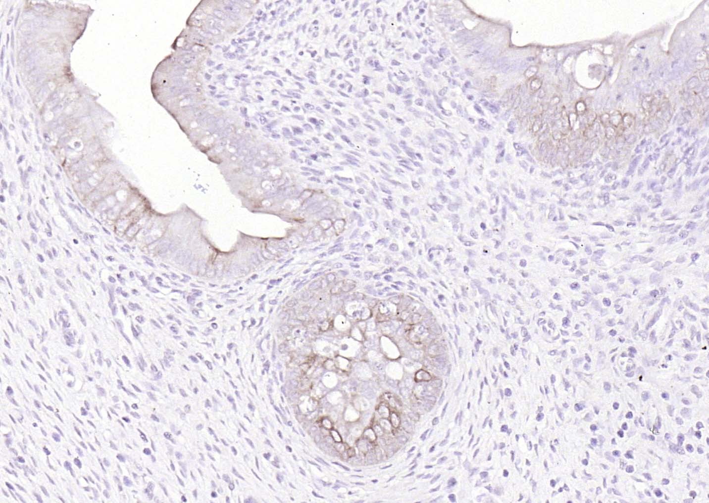 Anti-Pan Cytokeratin Polyclonal Antibody 2