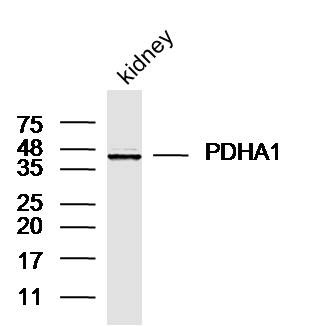 Anti-PDHA1 Polyclonal Antibody