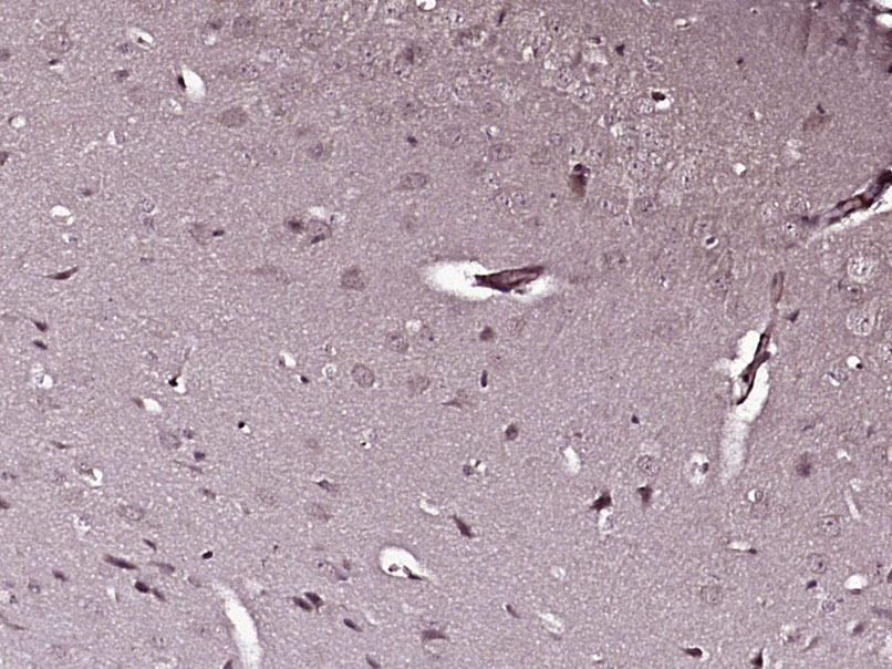 Anti-PDK1 Polyclonal Antibody