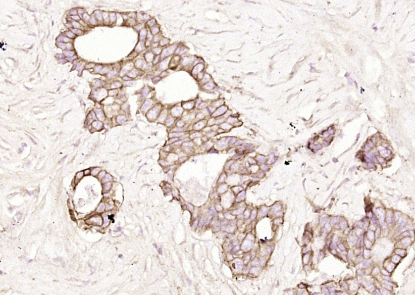 Anti-Pan Cytokeratin Polyclonal Antibody 2