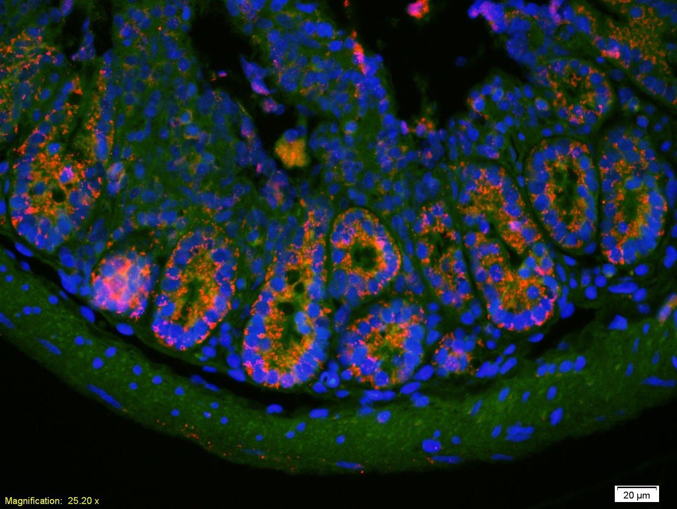 Anti-PAI-1 Polyclonal Antibody 2