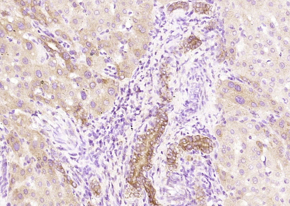 Anti-Pan Cytokeratin Polyclonal Antibody 2