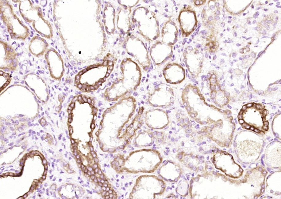 Anti-Pan Cytokeratin Polyclonal Antibody 2