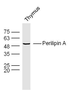 Anti-Perilipin A Polyclonal Antibody