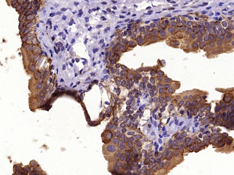 Anti-Pan Cytokeratin Polyclonal Antibody 2