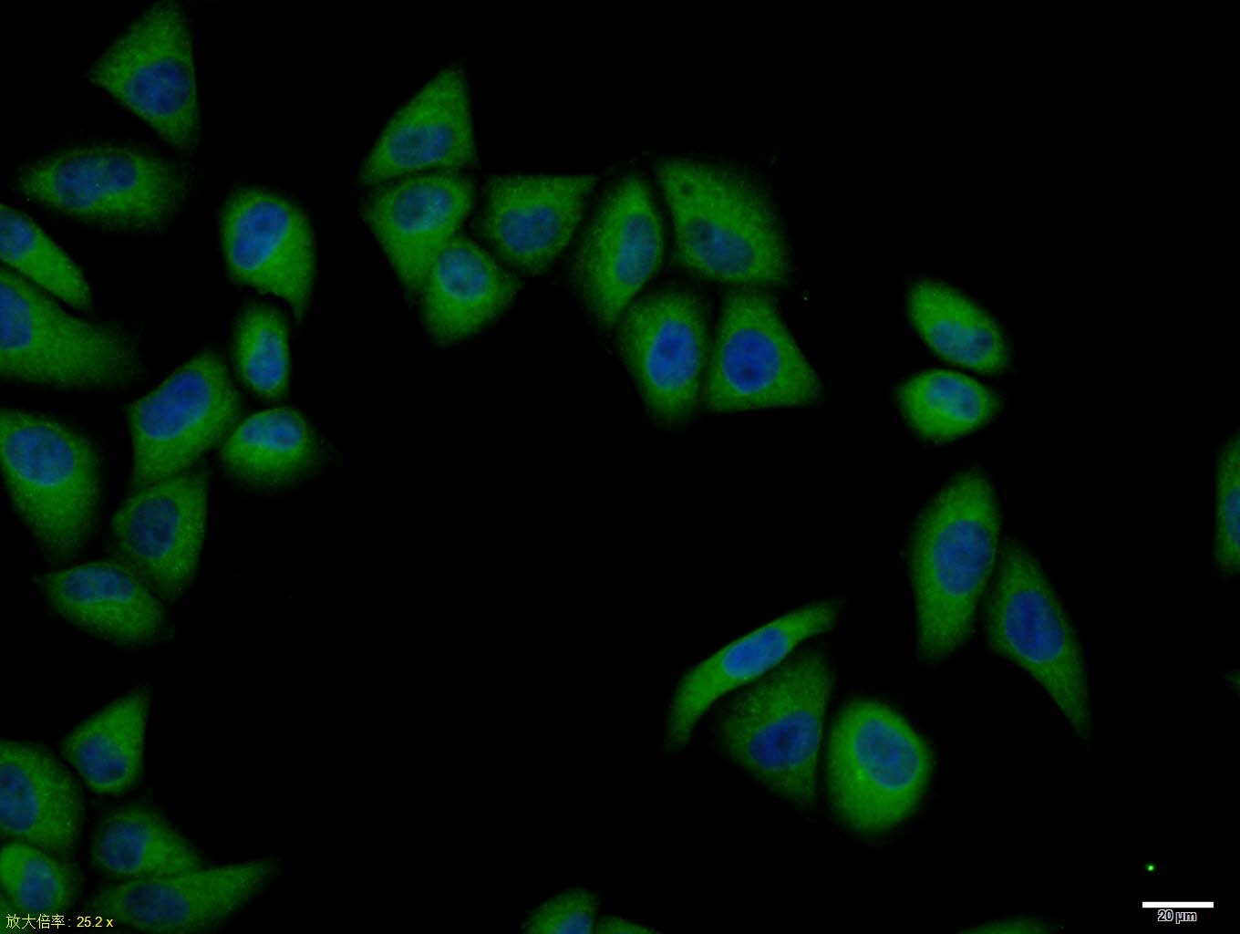 Anti-Pan Cytokeratin Polyclonal Antibody 2