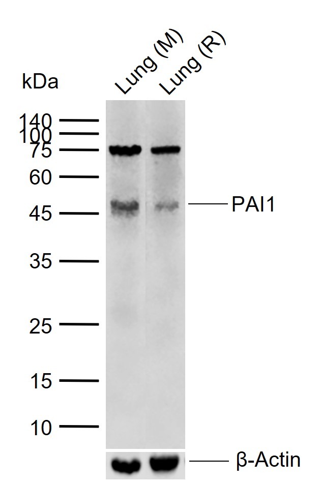 Anti-PAI-1 Polyclonal Antibody