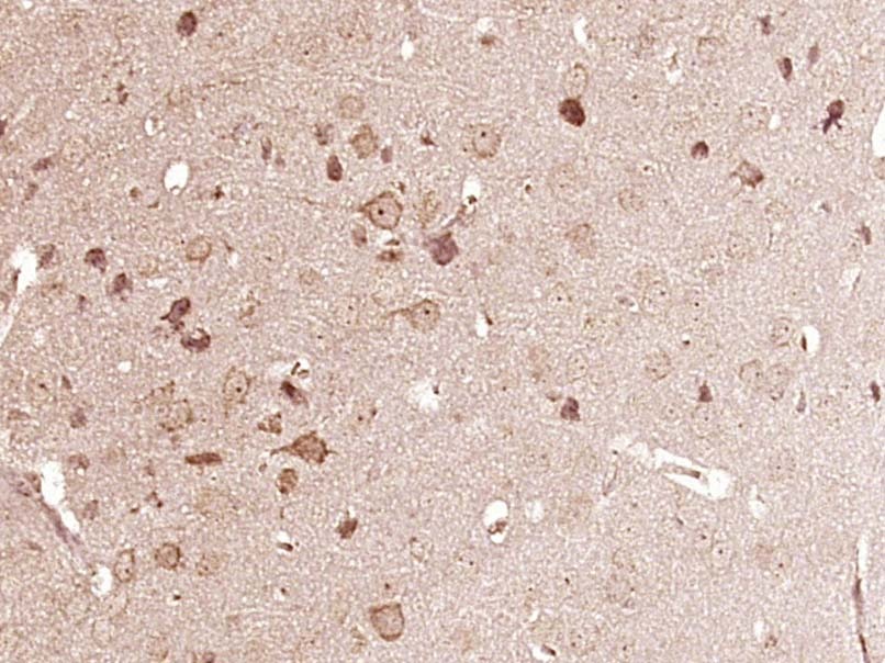 Anti-Phospho-Cofilin (Ser3) Polyclonal Antibody
