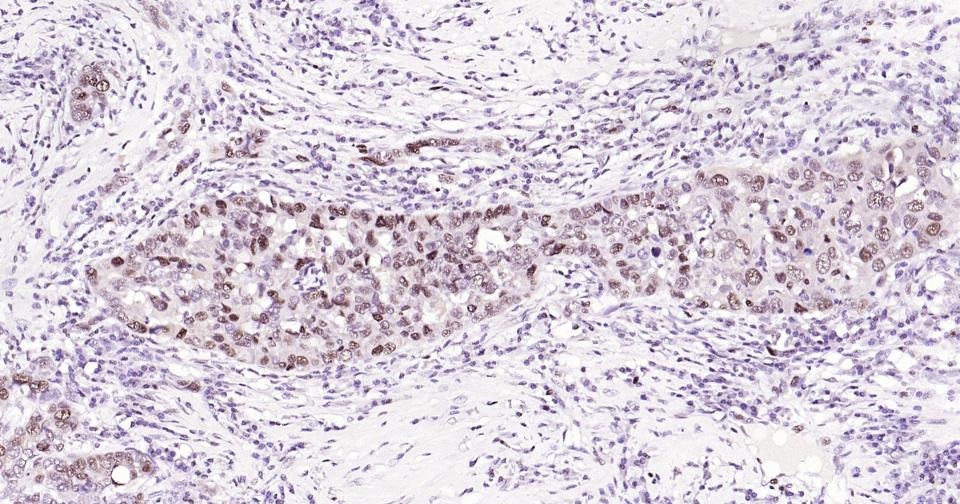 Anti-PCNA Polyclonal Antibody 2