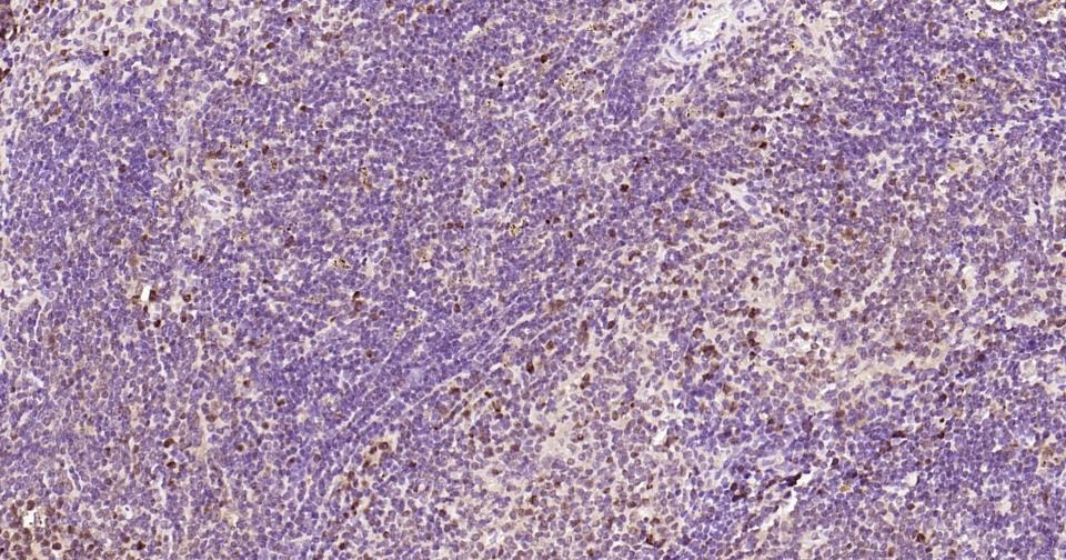 Anti-PCNA Polyclonal Antibody 2