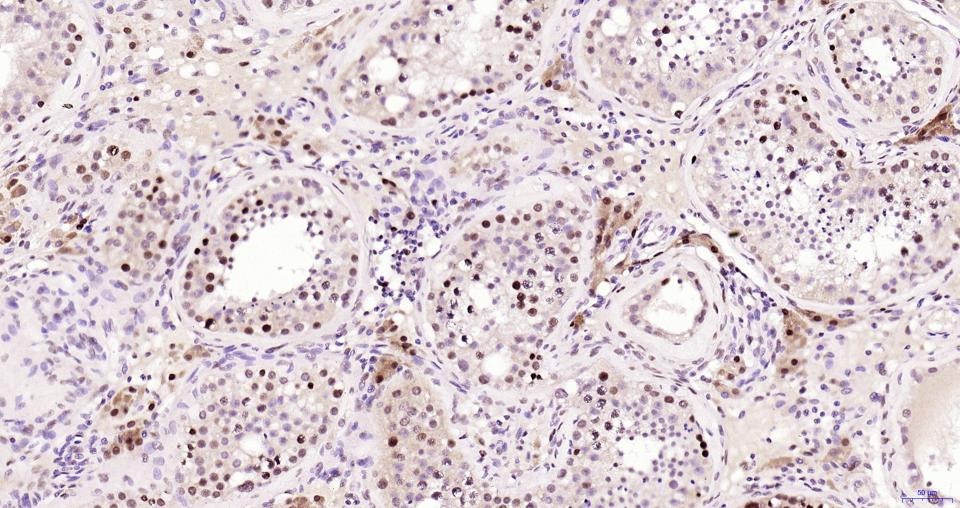 PCNA Nuclear Loading Control Polyclonal Antibody