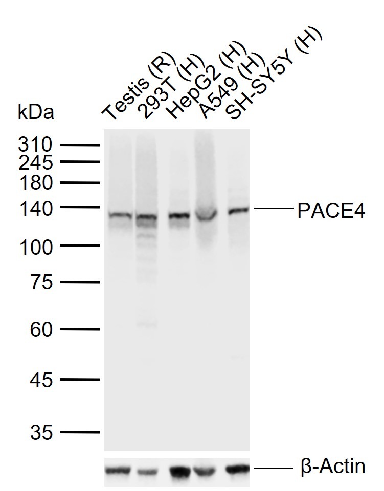 Anti-PCSK6 Polyclonal Antibody