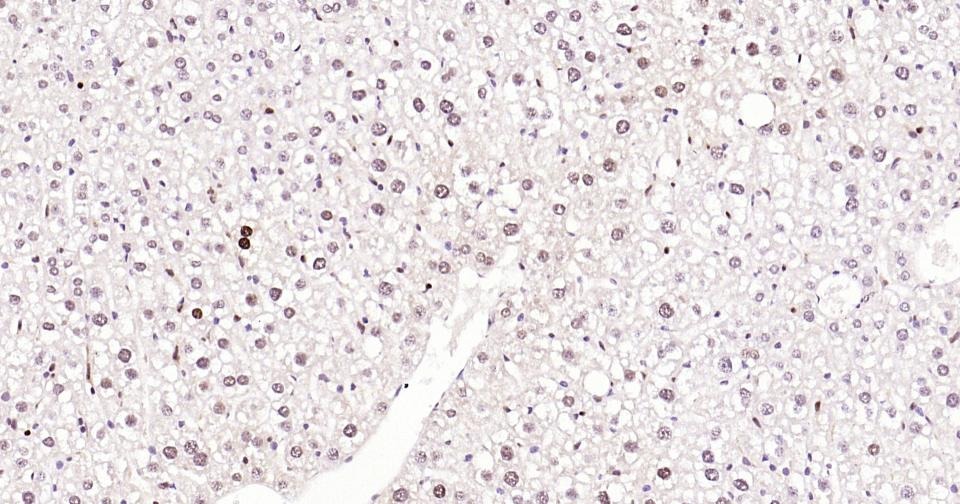 Anti-PCNA Polyclonal Antibody 2