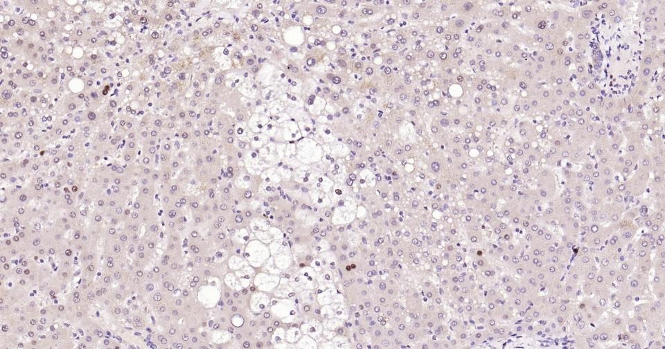 Anti-PCNA Polyclonal Antibody 2