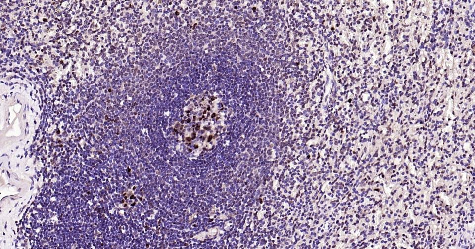 Anti-PCNA Polyclonal Antibody 2