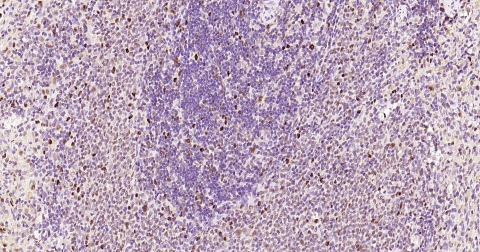 Anti-PCNA Polyclonal Antibody 2